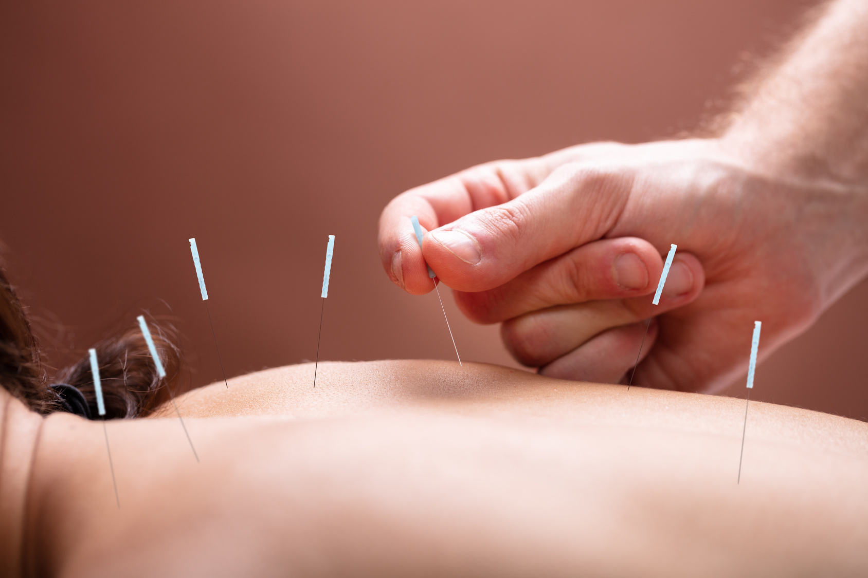 Acupunture : médecine ou charlatanisme ? © Andrey Popov, Fotolia